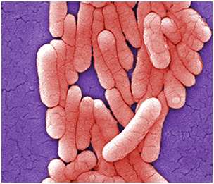 Бактерии вида Salmonellatyphimurium под электронным микроскопом